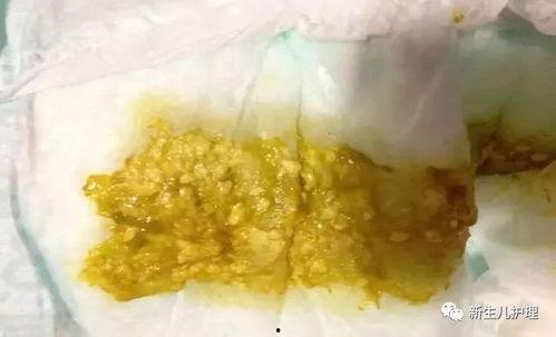宝宝吃蓝瓜拉肚子,警惕婴幼儿饮食安全